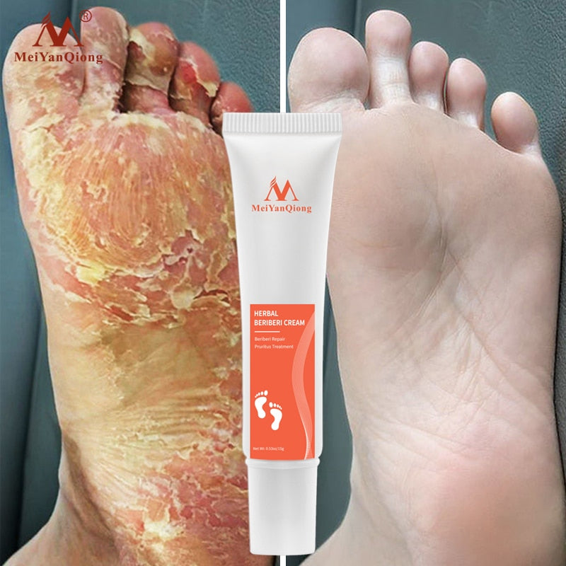 Foot Cream for Healing