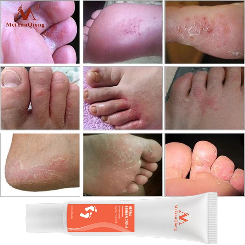 Foot Cream for Healing