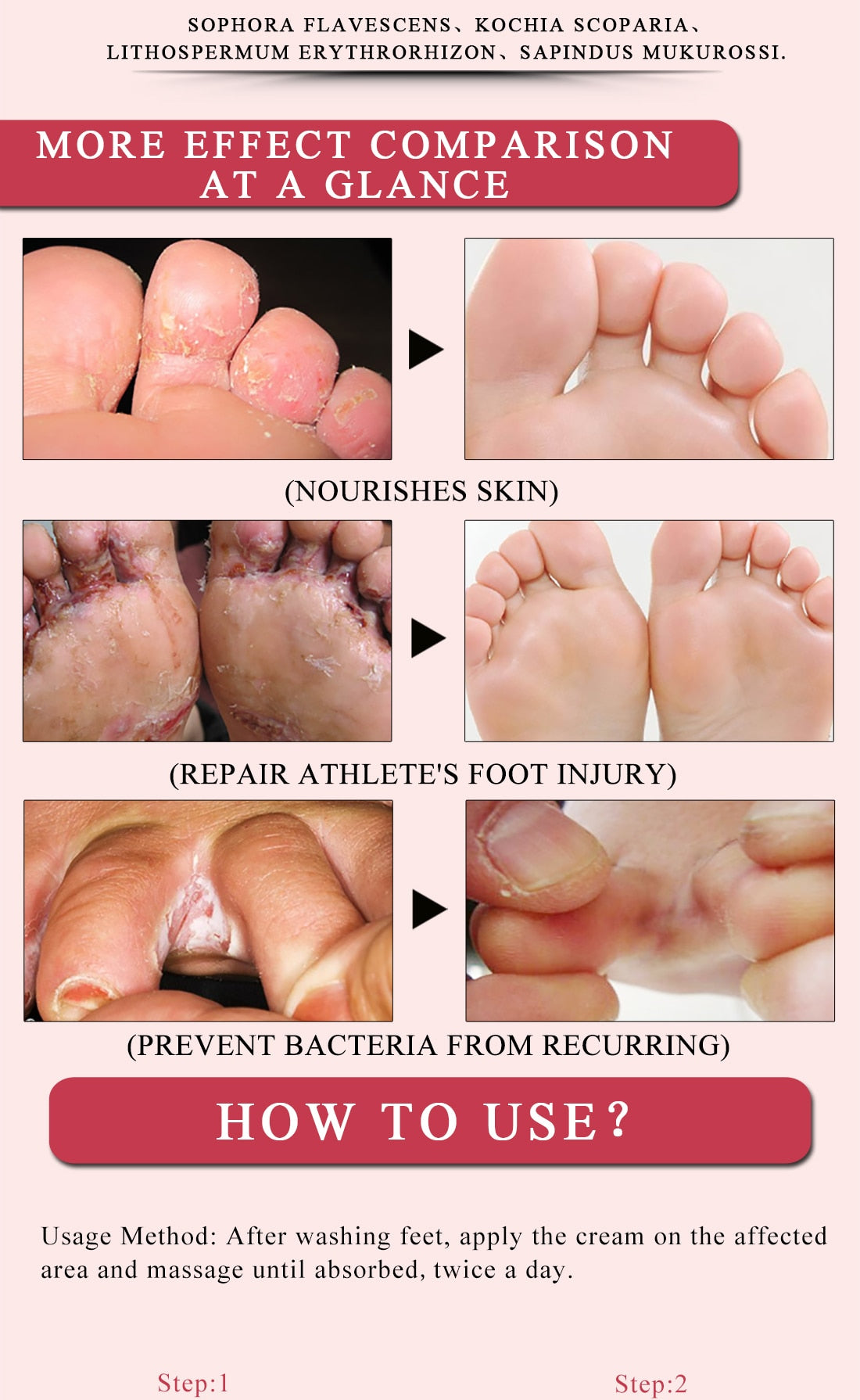 Foot Cream for Healing