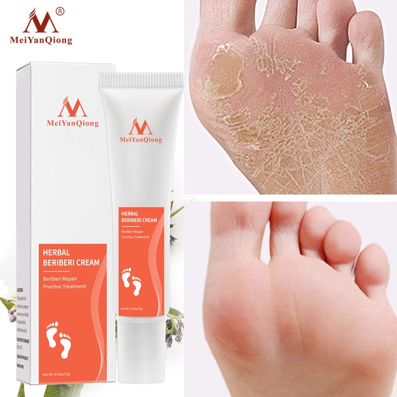 Foot Cream for Healing