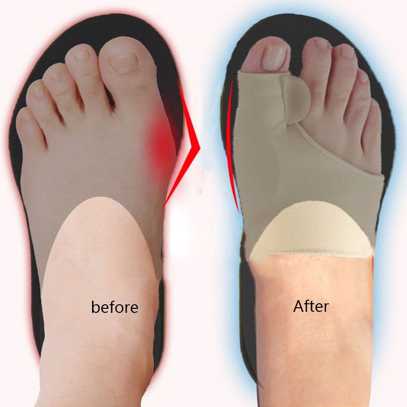 Big Toe Splint-Orthopedic Foot Care